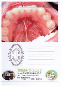 撮影した患部の様子 撮影した患部の様子